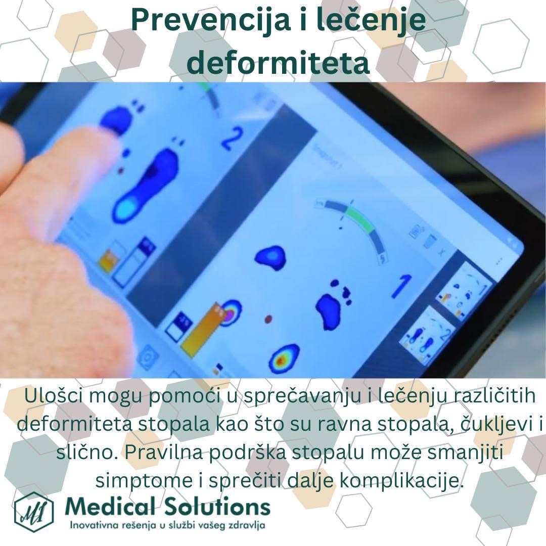 Analiza stopala na tabletu – plantogram sa raspodelom pritiska