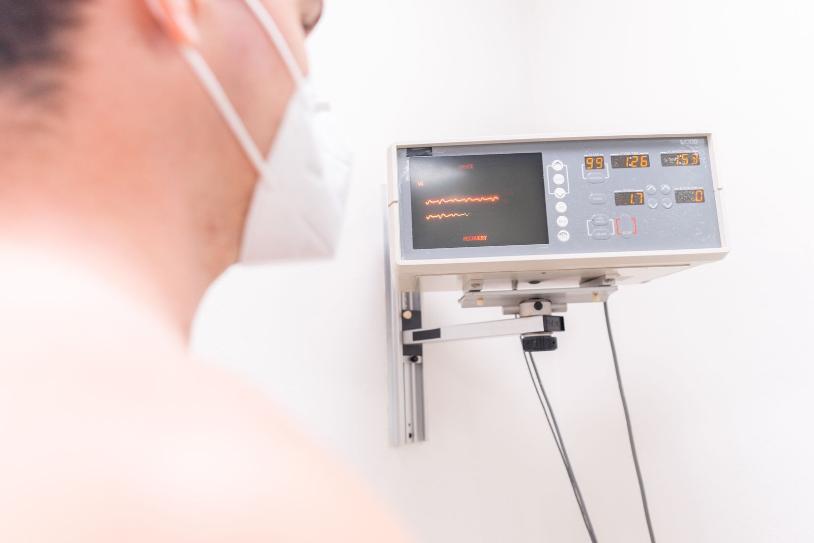 EKG monitor koji prikazuje otkucaje srca